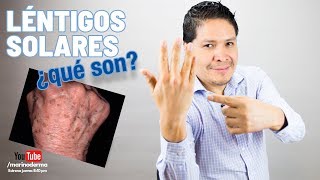 SPOTS ON YOUR HANDS? SOLAR LENTIGOS? II CAUSES II TREATMENTS II DR. MARINO, DERMATOLOGIST
