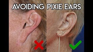 Avoid Pixie Ears