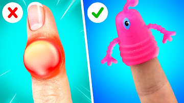EMERGENCY AND SURVIVAL HACKS FOR ALL OCCASIONS || Smart Tips For Parents By 123 GO!GOLD