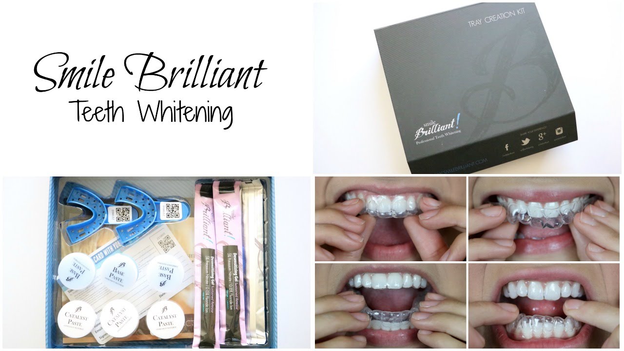 How To Get Whiter Teeth FAST! YouTube