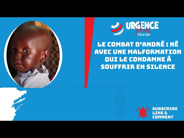 Le combat d'André : Né avec une malformation qui le condamne à souffrir en silence