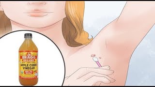 7 Easy Ways to Remove Skin Tags Without Seeing a Doctor