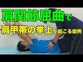 【肩関節の理学療法】肩関節屈曲時に肩甲帯挙上する症例への運動療法