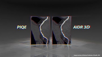 Precise IQ Engine (PIQE)