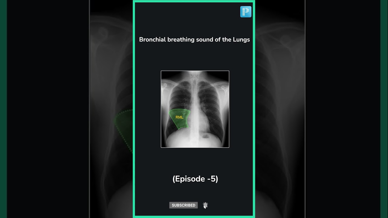Bronchial breathing Sound in the Lungs [Cause + Treatment] 