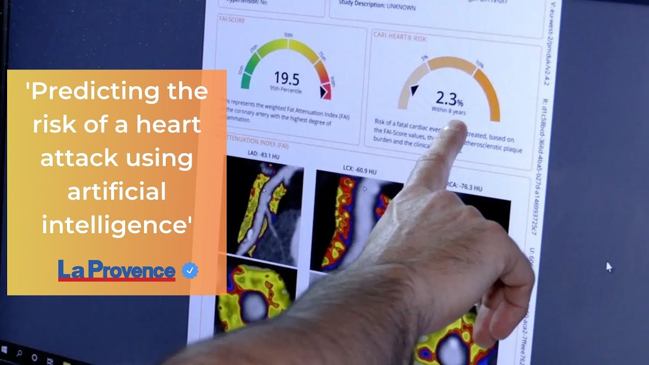 Predicting the risk of a heart attack using artificial intelligence | LA Provence