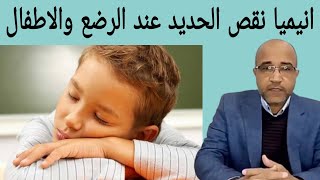 انيميا نقص الحديد عند الاطفال والرضع | العلاج الفعال للانيميا عند الرضع والاطفال | anemia in infants