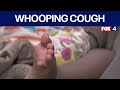 Texas whooping cough cases on the rise
