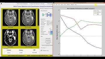 Brain Tumor Detection using Convolutional Neural Network CNN
