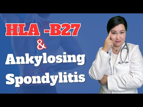 HLA-B27 and Ankylosing Spondylitis? All you need to know