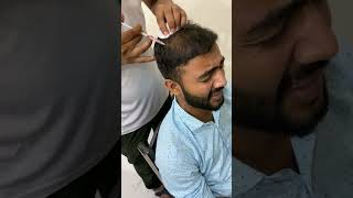 PRP treatment for hair loss  dekhe kitna saa pain hota hai 😃😃 life time chutty screenshot 5