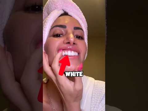 איך להלבין שיניים בבית 