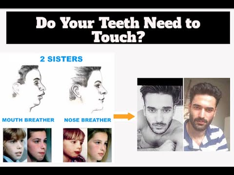When mewing should teeth touch?