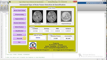 Matlab Code for Brain Tumor Types Detection and Classification Using Image Processing