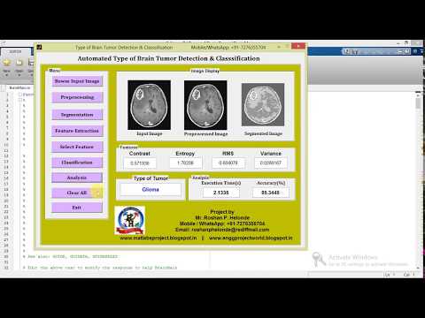Matlab Code for Brain Tumor Types Detection and Classification Using Image Processing