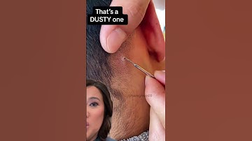 Terminal Hair in Scalp