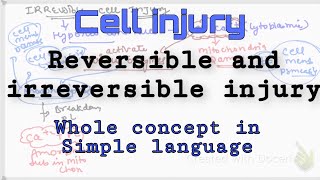 Reversible and Irreversible Cell injury  Cell injury -pathology lecture #pathology #Cell _injury