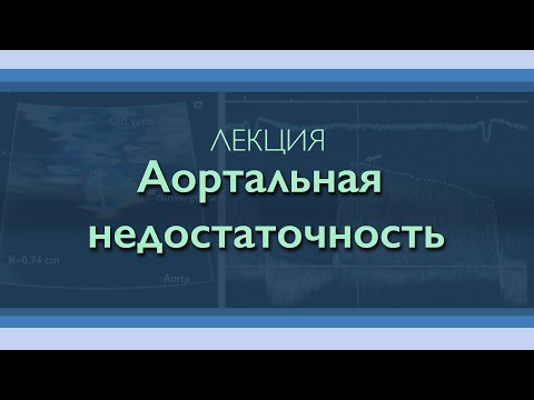 Аортальная недостаточность