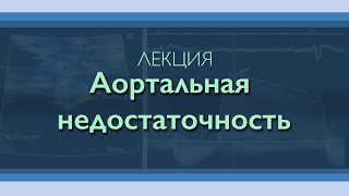 видео: Аортальная недостаточность картинка: Аортальная недостаточность