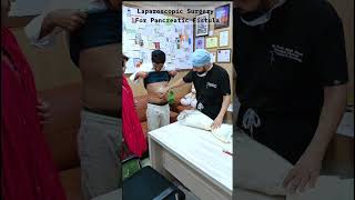 Pancreatic Fistula Treated with Laparoscopic Surgery | Minimally Invasive Solution