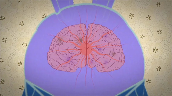 Debunking the myths of OCD   Natascha M  Santos  Edited version