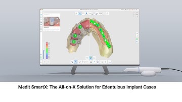 Medit SmartX : The All-on-X Solution for Edentulous Implant Cases