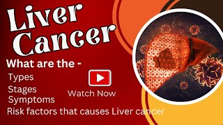 Liver Cancer | What are the types? | Stages | Symptoms | Risk factors that causes Liver cancer