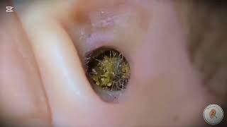 ASMR Ear Cleaning Deep Relaxing Cleaning Session