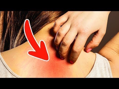 Vídeo: Câncer De Pulmão E Dor No Ombro: Existe Uma Conexão?