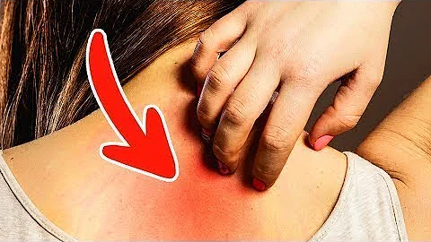 Como a pessoa adquire o câncer?