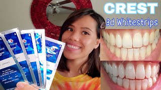 I tried Crest 3d Whitestrips Full 10 days result | Before and After Review