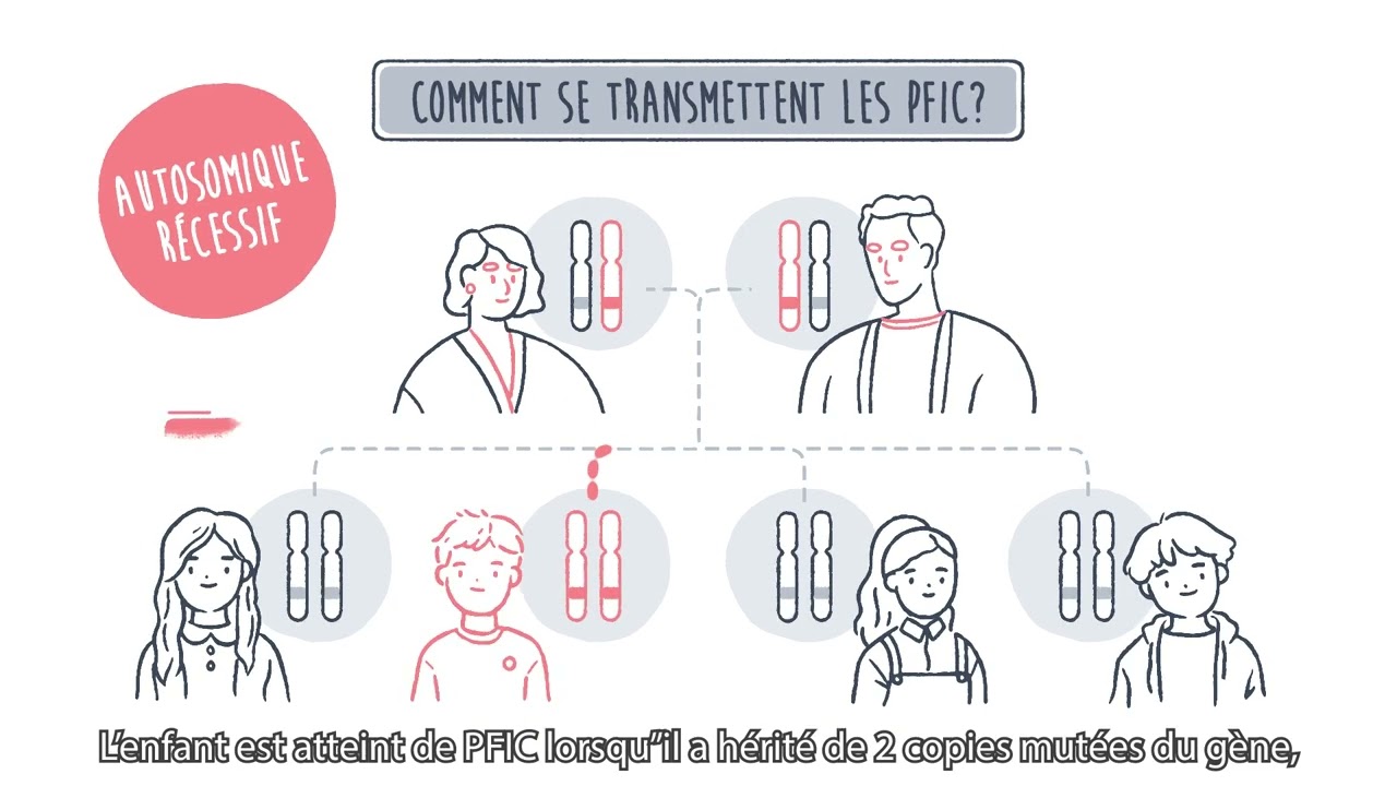 Cholestases Intrahépatiques Familiales (PFIC) + Message d’alerte 