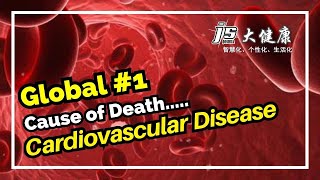 Cardiovascular Disease Today's Global #1 Cause of Death l JS Joshua