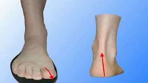 Think you need arch supports or custom orthotics?