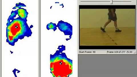 F-Scan™ XL Sensors for In-Shoe Gait Analysis