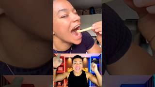 Ela não consegue morder uma batata frita! #curiosidades #dentista #humor