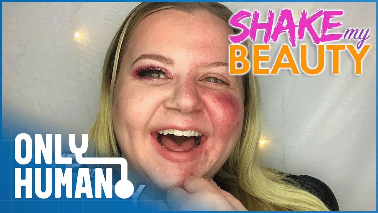 Struggles With Cystic Acne & Re-defining What Beauty Means: Shake My Beauty (2018) S1E1 | Only Human