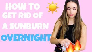 HOW TO GET RID OF A SUNBURN OVERNIGHT & NATURALLY TAN FAST | ANNDAWG