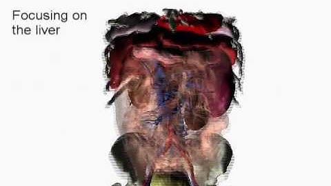 Preserving Topology and Elasticity for Embedded Deformable Models - SIGGRAPH