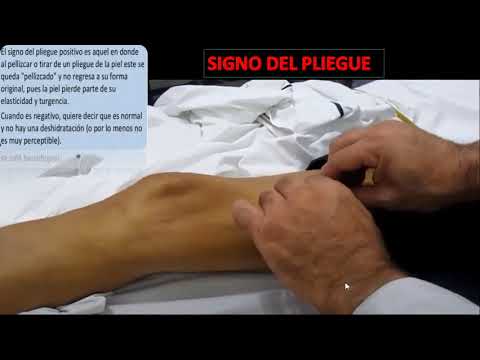 Signo del Pliegue