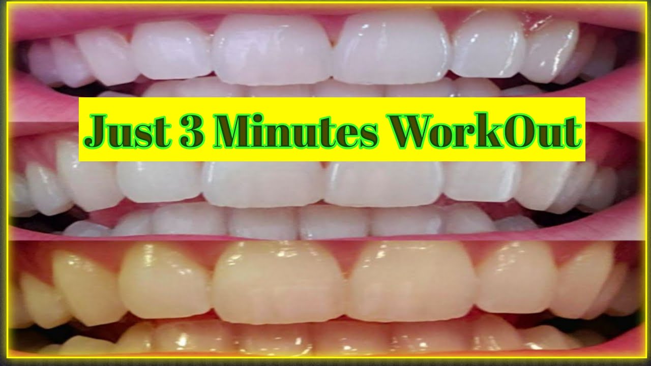 teeth whitening at Home In 3 Minutes In Hindi How to whiten your