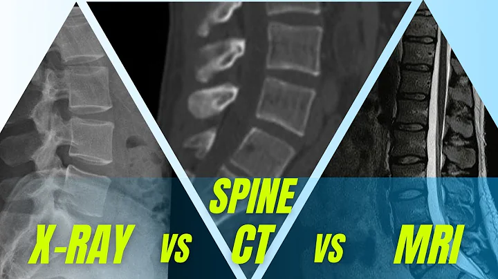 Three different tests for your back: X-ray, CT and MRI