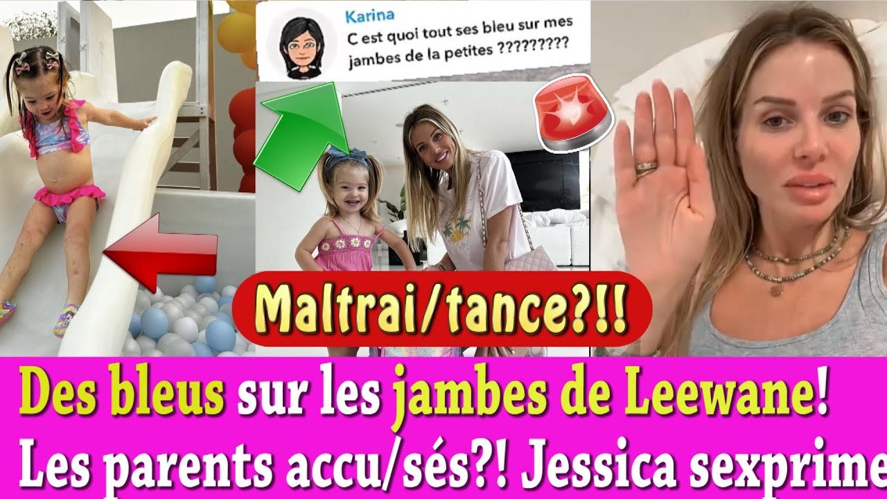 Pourquoi Jessica A Des Bleus