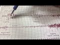 Coughing and Sneezing | Stethography Physiology practical | Sagarika Basavaraj
