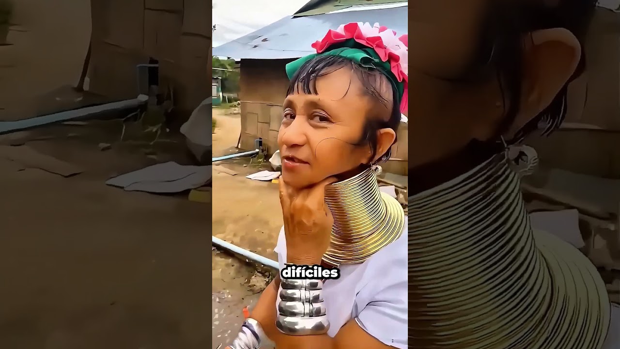 La Dolorosa Verdad Detrás De Los Anillos para el Cuello😰 #shorts #education