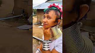 La Dolorosa Verdad Detrás De Los Anillos Para El Cuello