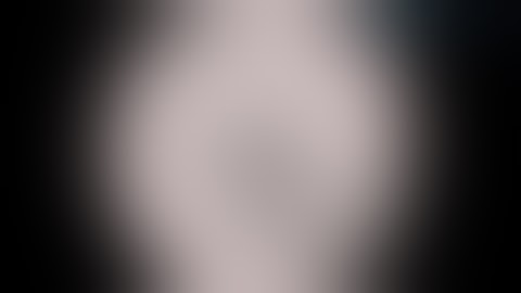 Minimally invasive closure of a PDA.