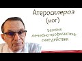 Атеросклероз, базовые лечебно-профилактические действия. Видеобеседа для ВСЕХ