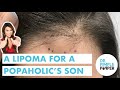 A Lipoma for a Popaholic's Son