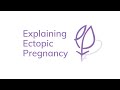 Explaining Ectopic Pregnancy: What are the symptoms of ectopic pregnancy? (subtitles)
